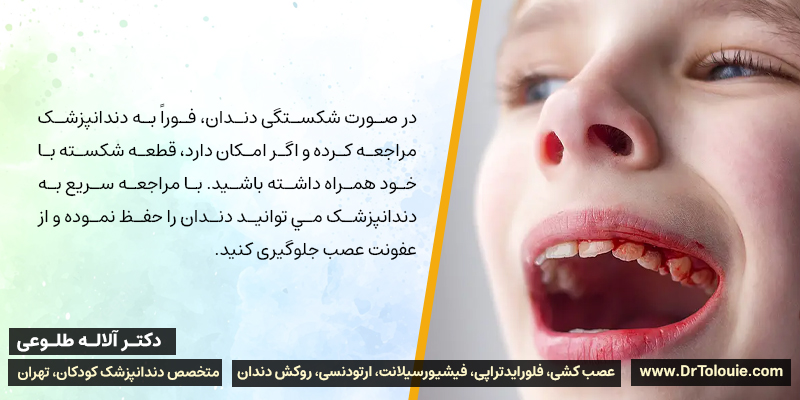 در صورت شکستگی دندان، فوراً به دندانپزشک مراجعه کنید